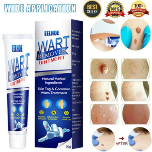 INSTANT WARTS REMOVER CREAM-😍 RATING⭐⭐⭐⭐⭐(4.9/5) 78,564+ CUSTOMERS