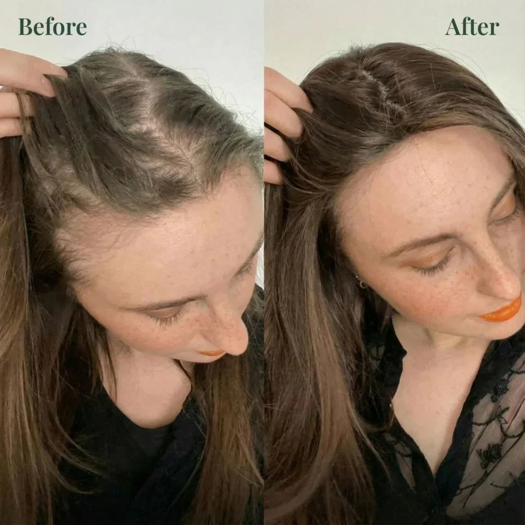 Kerarose Rosemary Shampoo Buy 1 Get 1 Free